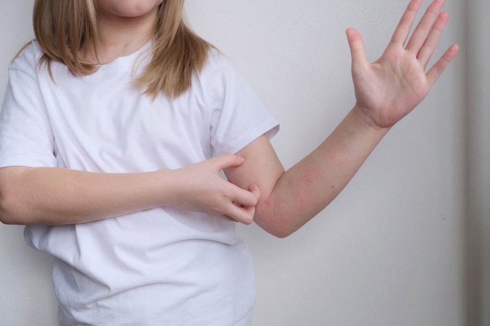 Dermatite  da contatto: che cos'è e a cosa prestare attenzione